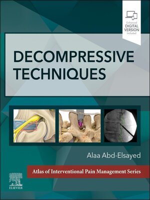cover image of Decompressive Techniques--E-Book